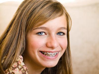 girl with blue eyes and braces in Erina