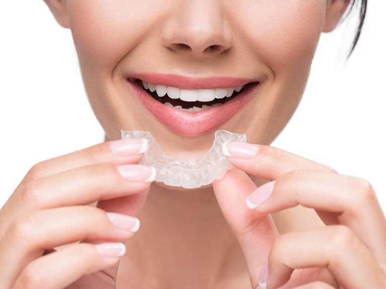 An image of a woman holding 3-D printed Clear Aligners in Erina