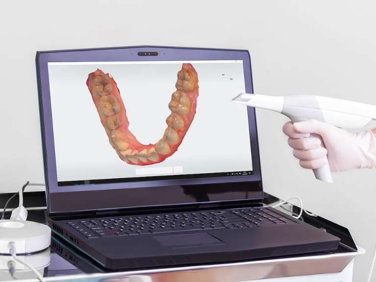 an image of an Intraoral Scanner and a laptop in Erina